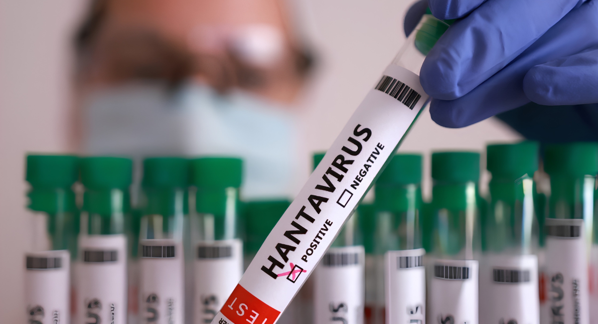 Turista da positivo a hantavirus tras viaje en Francia; se encuentra aislado en Galicia