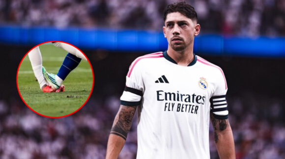Real Madrid pierde a Valverde; el uruguayo sufrió esguince de grado 3 y podría ser baja por varios meses