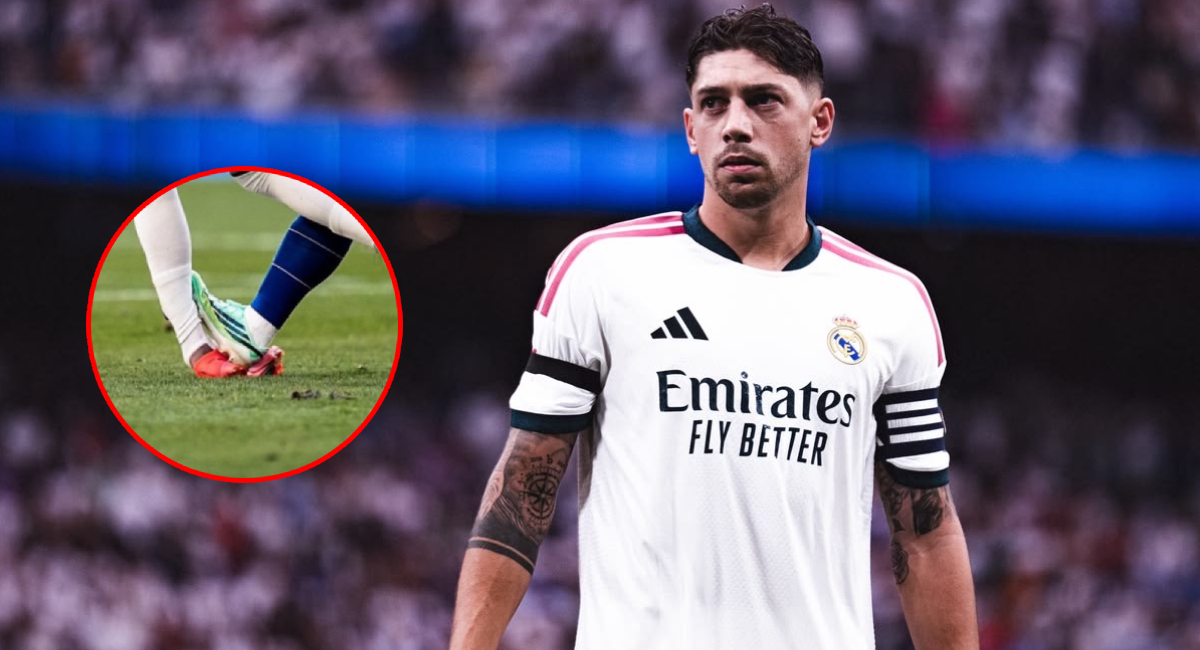 Federico Valverde fue diagnosticado con un esguince de tobillo grado 3 tras la falta sufrida en el duelo ante el Atlético de Madrid