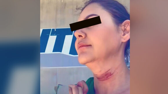 Mujer se lanza de puente tras denunciar mala cirugía estética en Tijuana; publicó VIDEO antes de morir