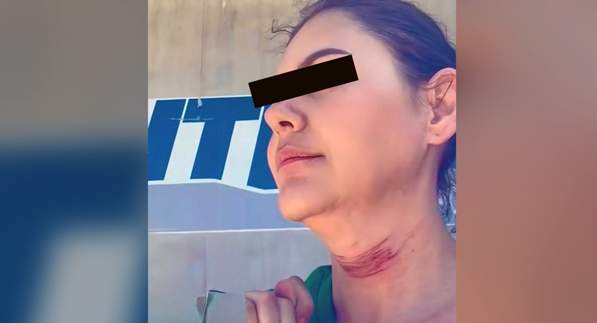 Mujer se lanza de puente tras denunciar mala cirugía estética en Tijuana; publicó VIDEO antes de morir