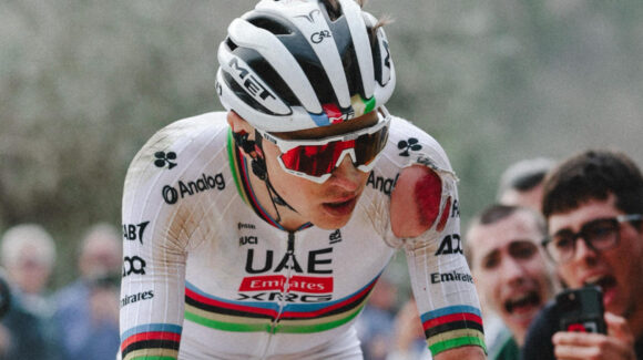 Tadej Pogacar recibe el alta médica tras ser operado por su caída en la Vuelta a España 2026
