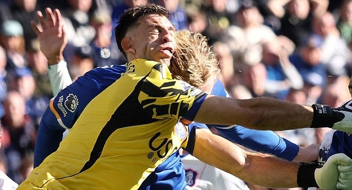Emiliano Martínez fue operado con éxito luego de haber sufrido una fractura de mandíbula en la Premier League