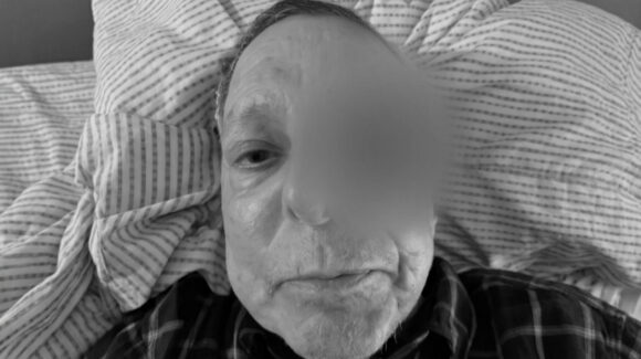 Familia de César Bono desmiente que el actor haya perdido un ojo tras cirugía; aclara su estado de salud
