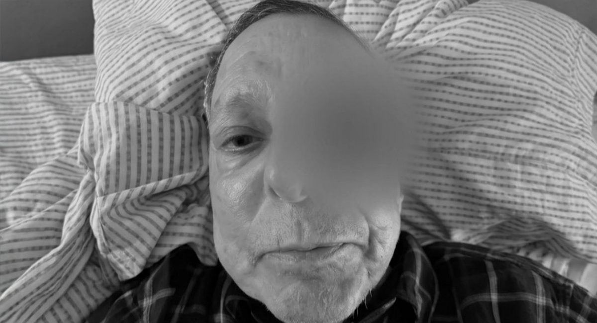 Familia de César Bono desmiente que el actor haya perdido un ojo tras cirugía; aclara su estado de salud