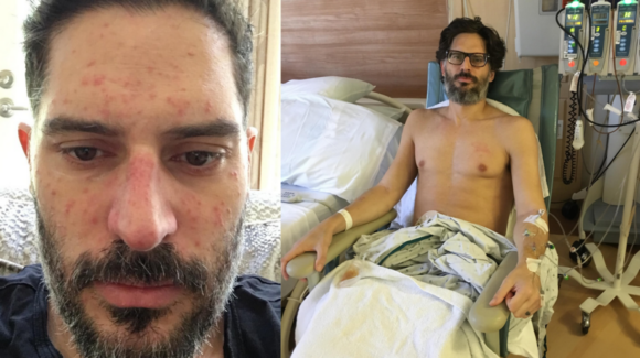 Joe Manganiello revela fotos de su grave enfermedad y cuenta que sospechó de una supuesta maldición vudú