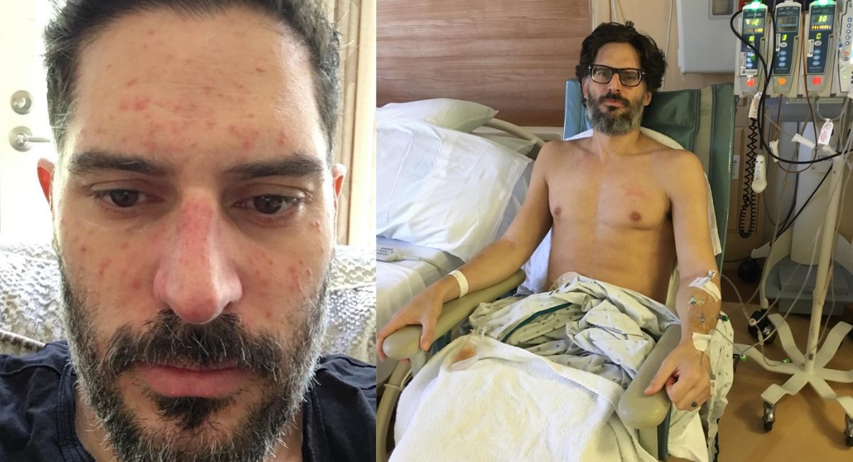 Joe Manganiello revela fotos de su grave enfermedad y cuenta que sospechó de una supuesta maldición vudú