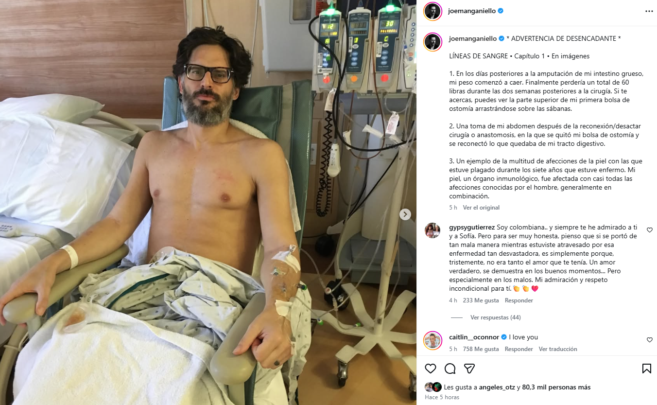 Joe Manganiello revela fotos de su grave enfermedad y cuenta que sospechó de una supuesta maldición vudú