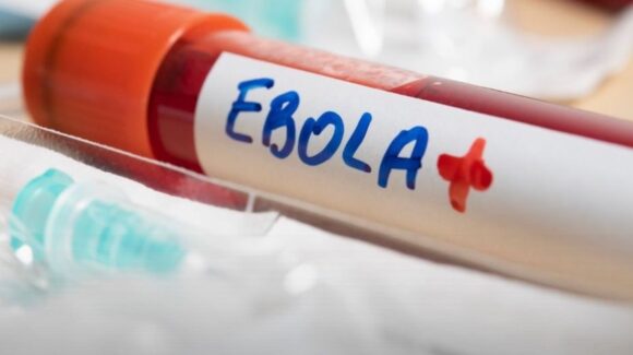 Brote de Ébola en el Congo supera los 10 mil casos y casi 5 mil muertes: ¿Ya hay vacunas?