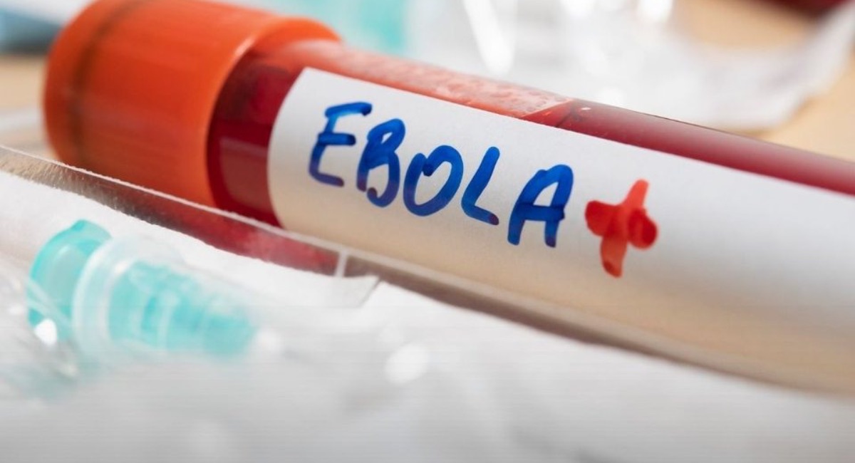 Ébola en el Congo supera los 10 mil casos y casi 5 mil muertes